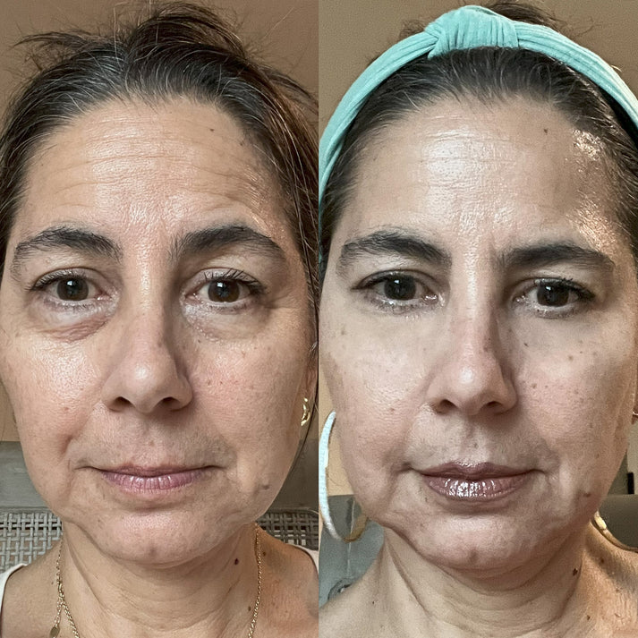 Radiant Gaze - Red Light Therapy Glasses