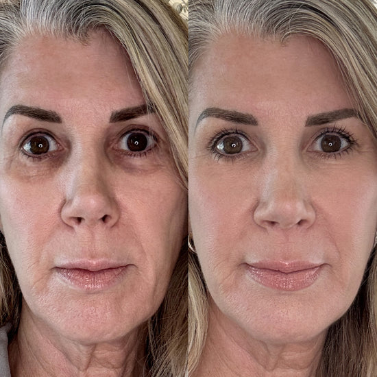 Radiant Gaze - Red Light Therapy Glasses