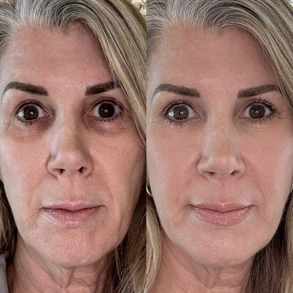 Radiant Gaze - Red Light Therapy Glasses
